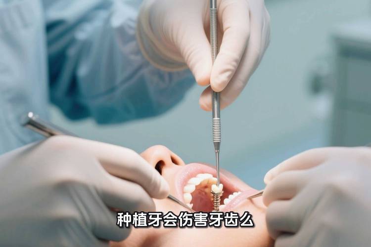 爱康健植牙-图3 爱康健植牙-图3