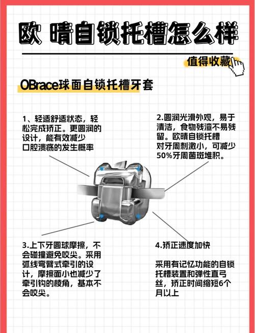 自锁牙套 正畸原理-图1 自锁牙套 正畸原理-图1