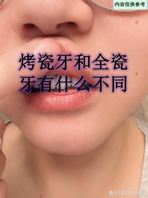 有烤瓷牙能做正畸矫正吗？-图3