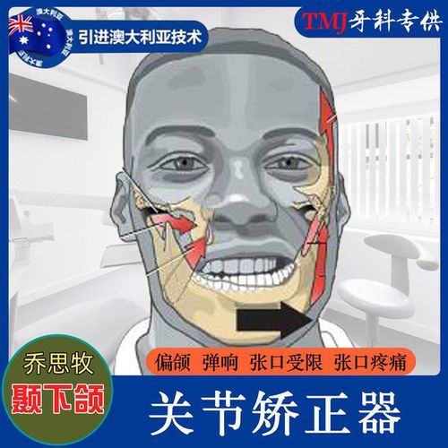 颞颌关节紊乱做正畸-图1