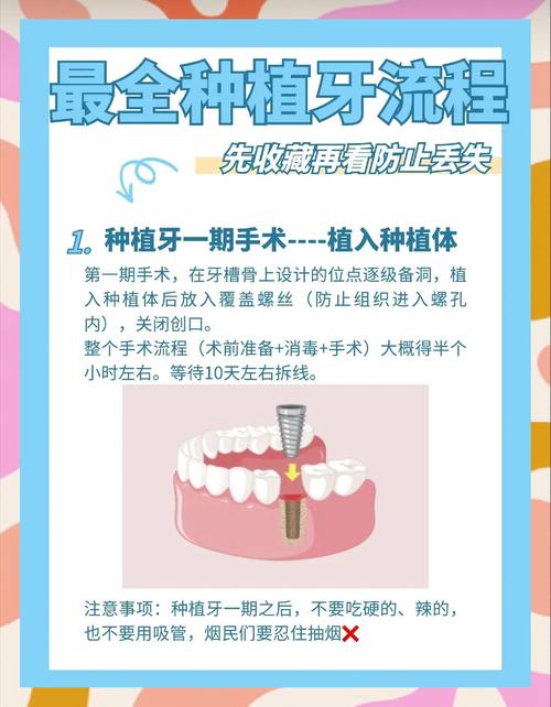 植牙前需注意哪些关键事项？风险规避、准备流程及注意事项疑问-图2