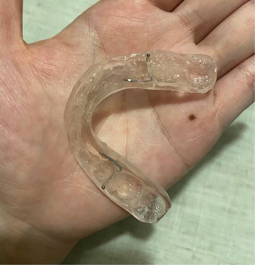 正畸颌垫是干嘛用的-图3