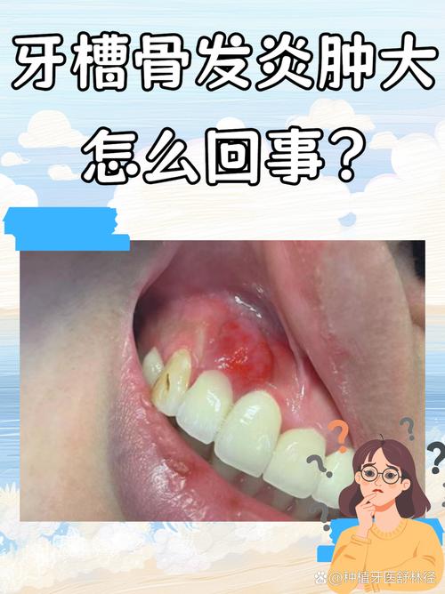 植牙后发炎-图3