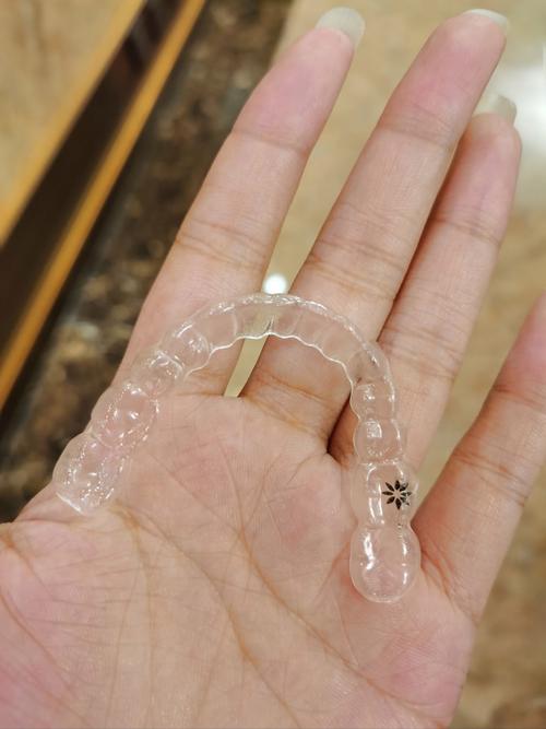 北大口腔正畸为何受欢迎?效果如何?-图2 北大口腔正畸为何受欢迎?效果如何?-图2