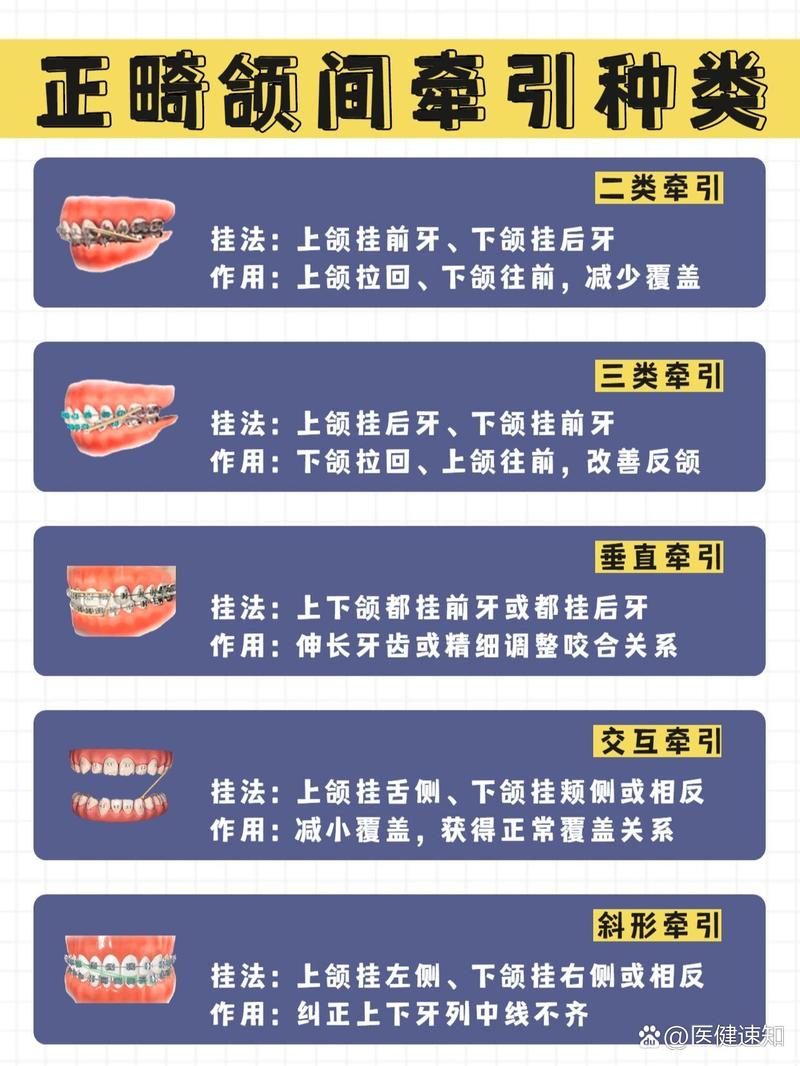 二类二分类 正畸-图1 二类二分类 正畸-图1