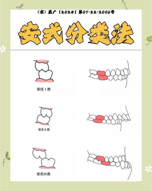 二类二分类 正畸-图3 二类二分类 正畸-图3