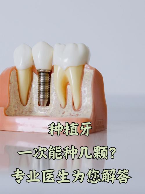 植得种植牙效果如何？真的能用一辈子吗？-图1