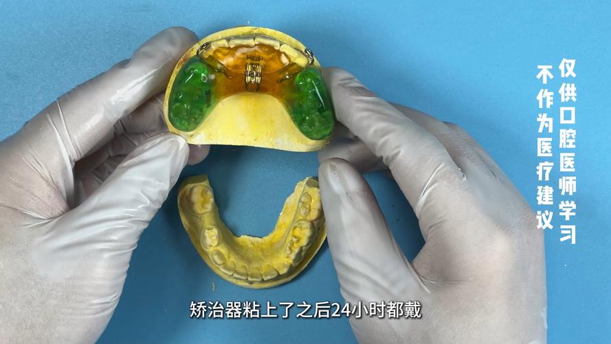 八岁做牙齿正畸扩弓，时机合适吗？效果如何？-图1