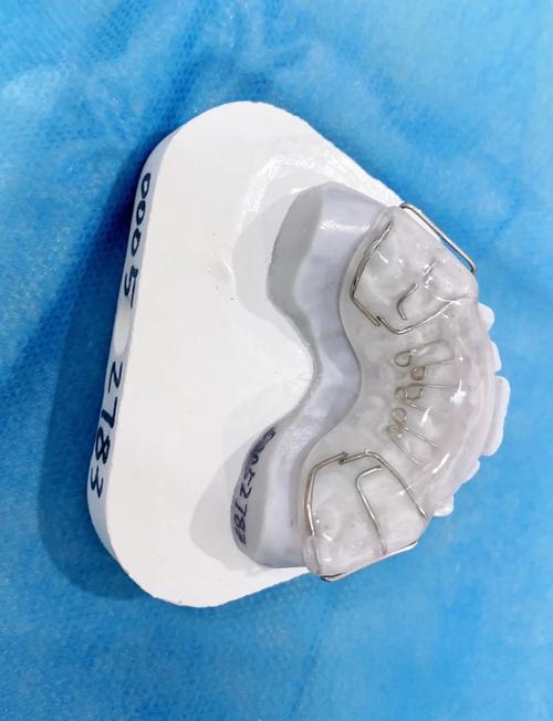 正畸弹簧吞下去了-图1