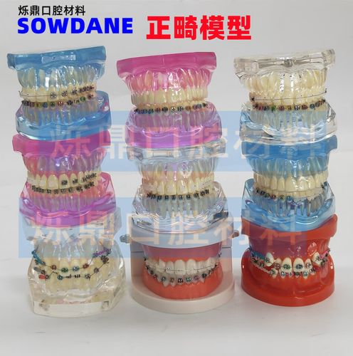 直丝弓正畸矫正器-图3 直丝弓正畸矫正器-图3