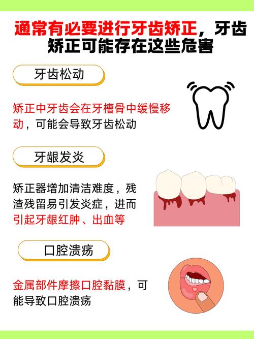 正畸一定要用酸蚀-图1