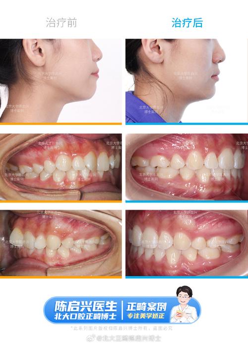 北京大学海外正畸-图1