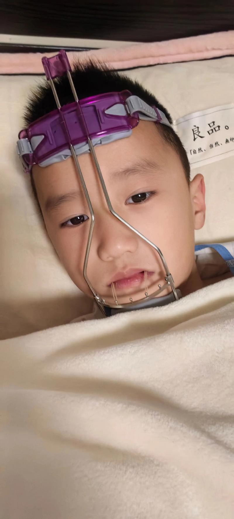 正畸三类牵引会痛吗？求解答原因和应对方法-图3