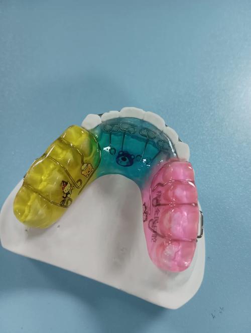 正畸颌垫推簧弯制-图1 正畸颌垫推簧弯制-图1