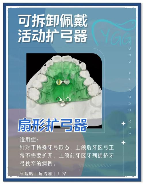 正畸扩弓的适应症-图2