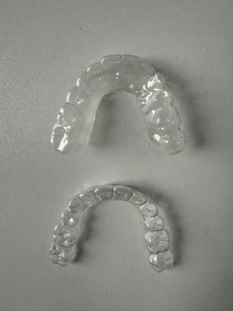 正畸保持器到底有没有用？不戴会反弹吗？-图2