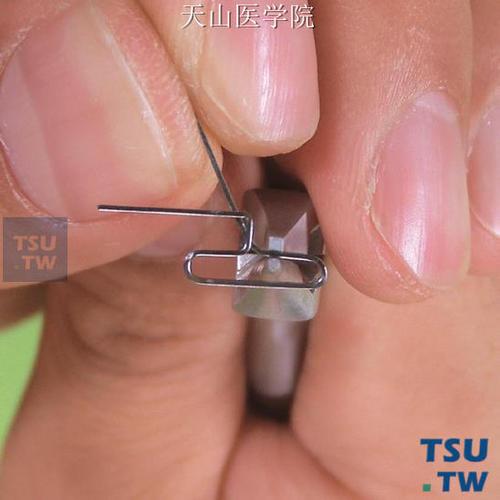 正畸T形曲在牙齿矫正中的主要目的是什么？-图2