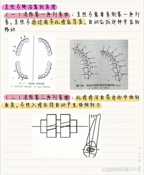 正畸第二序列弯制-图1