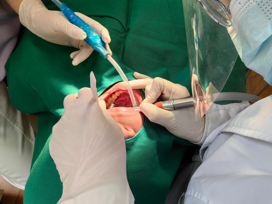 烤瓷牙拔掉做正畸-图1