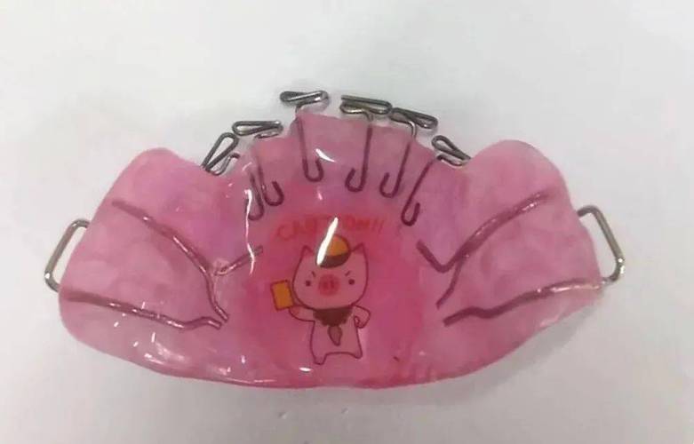 上推簧非拔牙正畸，如何避免拔牙又能有效矫正牙齿？-图2