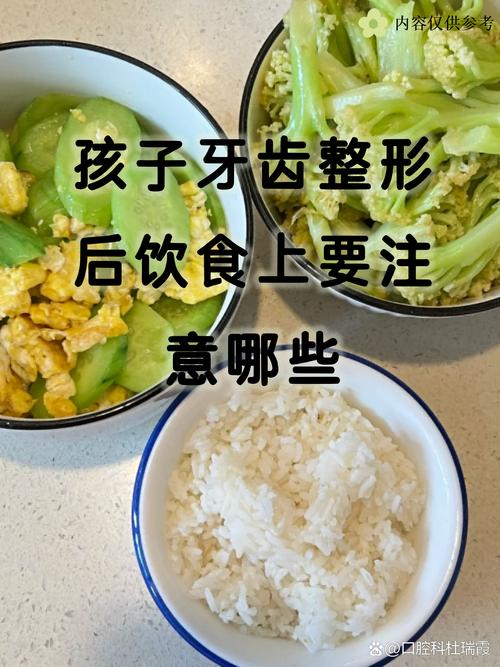 正畸带牙套的食物-图2