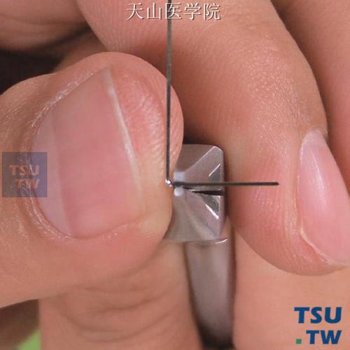 正畸t型曲怎么弯-图2 正畸t型曲怎么弯-图2