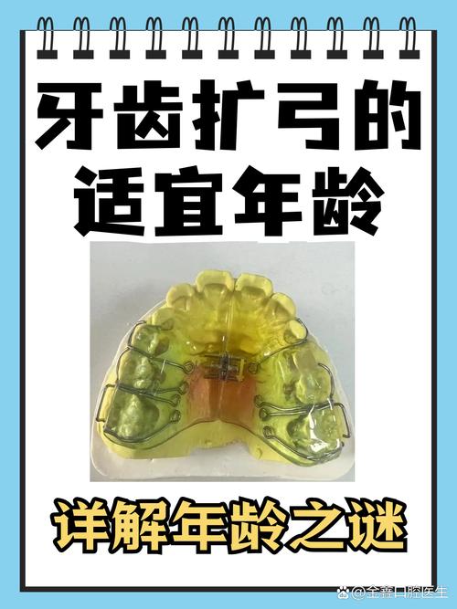 正畸后牙齿还能扩弓矫正吗？-图3