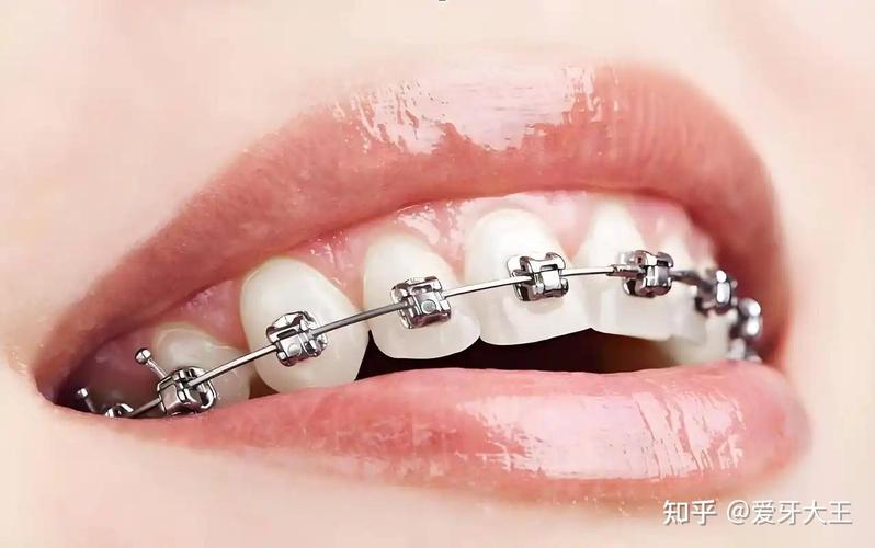 新亚正畸颈带规格-图2