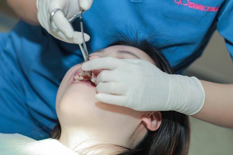 邻面去釉正畸效果如何？安全性与持久性怎么样？-图3