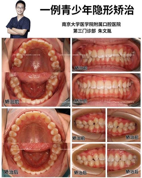 口腔科正畸科图片-图1
