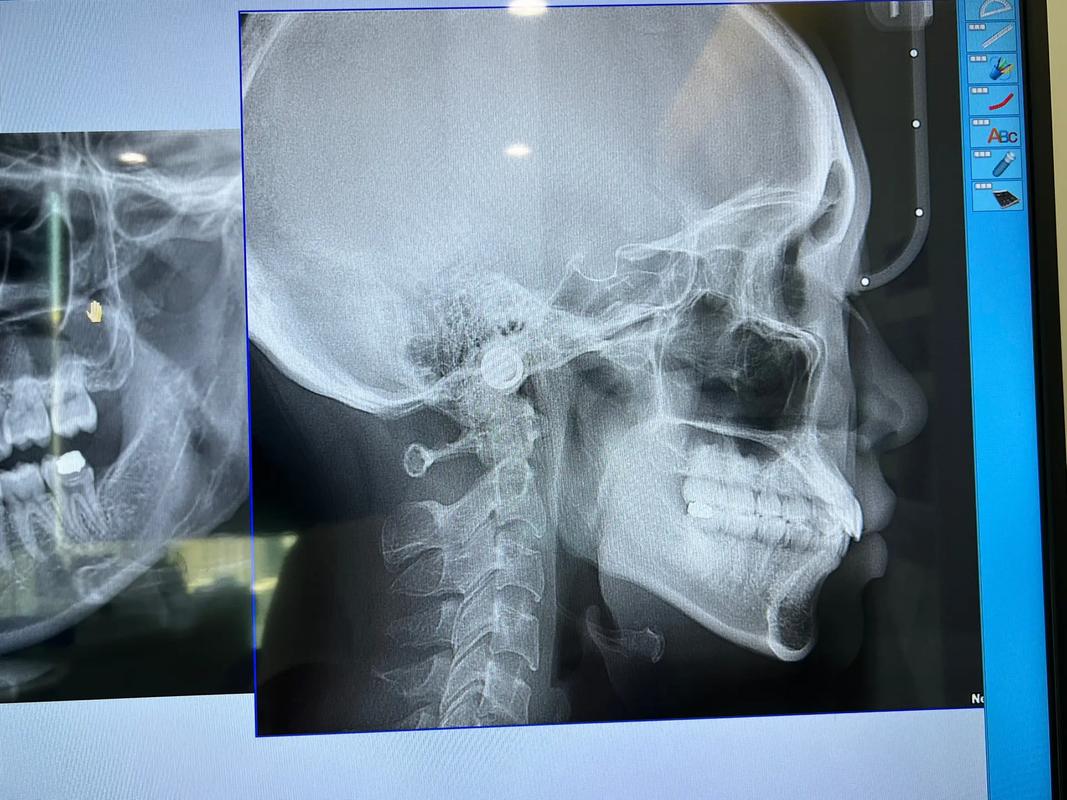 口腔科正畸科图片-图3