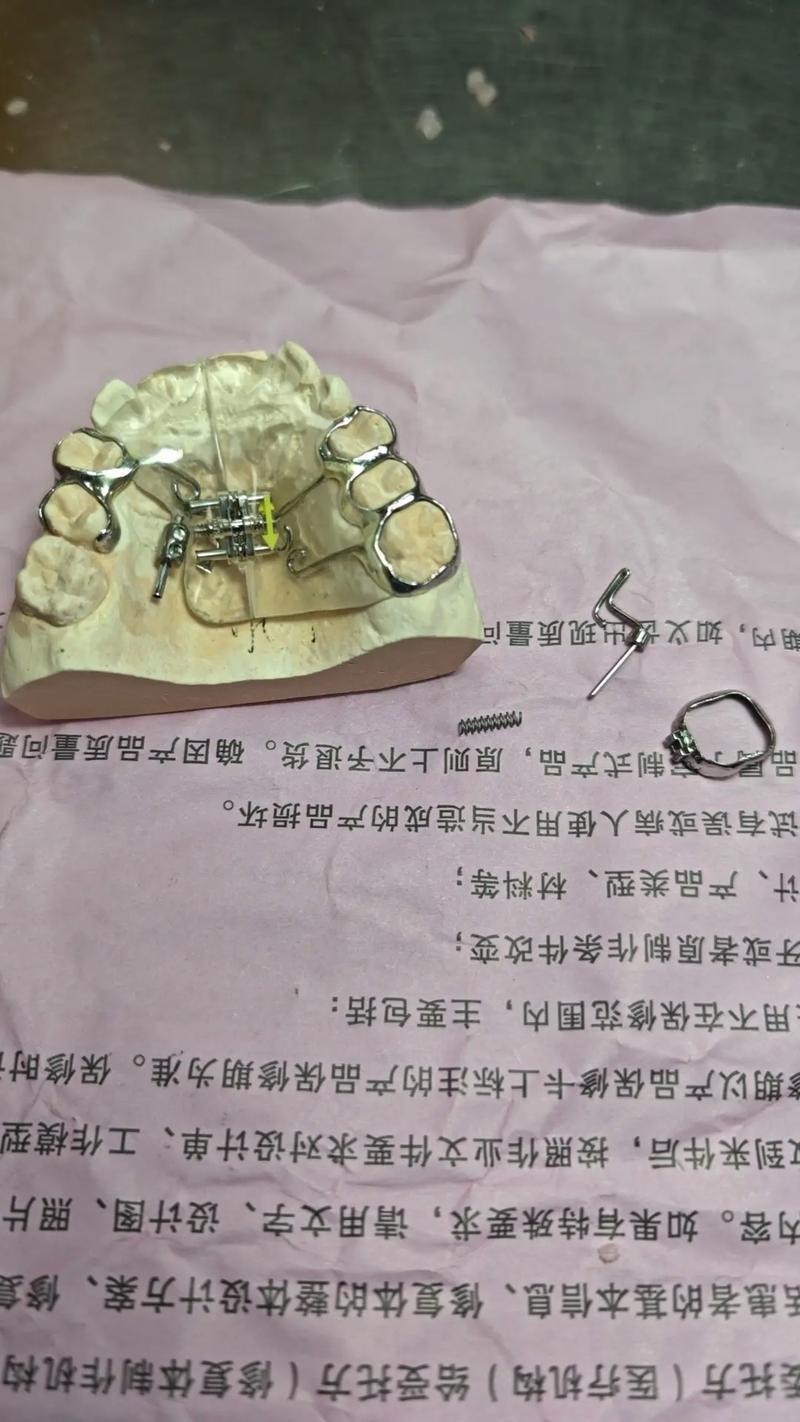 做正畸推簧的步骤-图1 做正畸推簧的步骤-图1