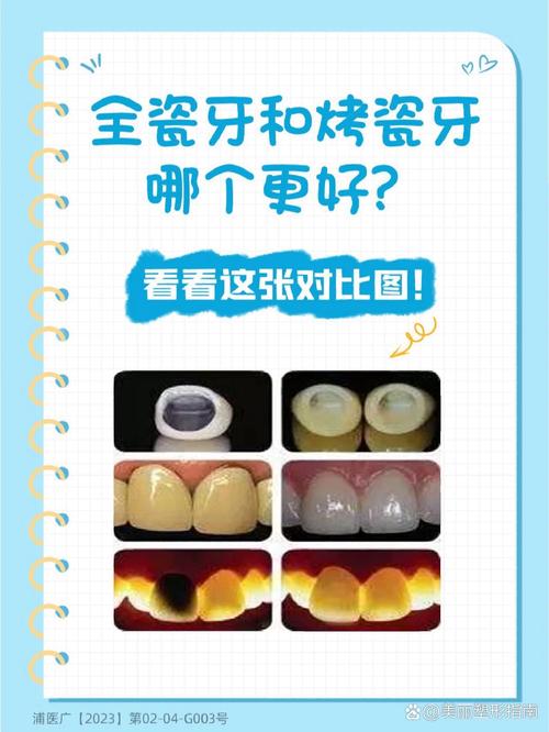 牙齿正畸和烤瓷牙有何区别？哪种情况更适合选择？-图1