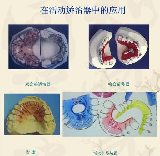正畸丝弯环在牙齿矫正中有哪些关键作用？-图1