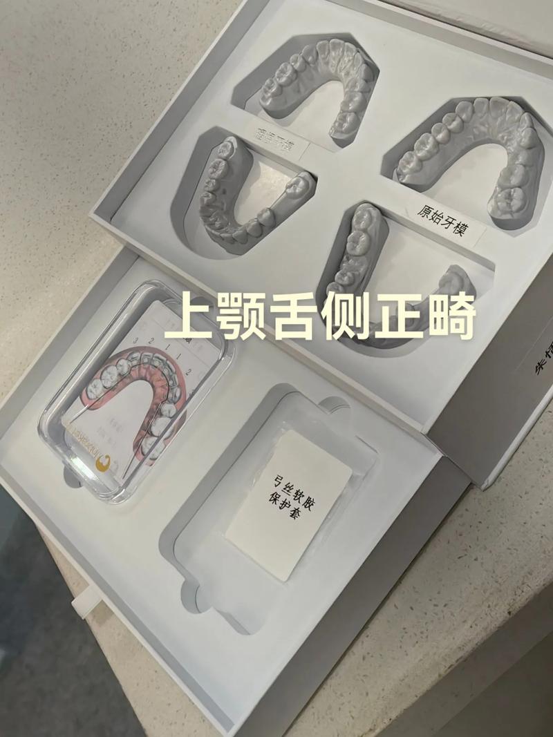 正畸舌侧扣舌头痛-图2