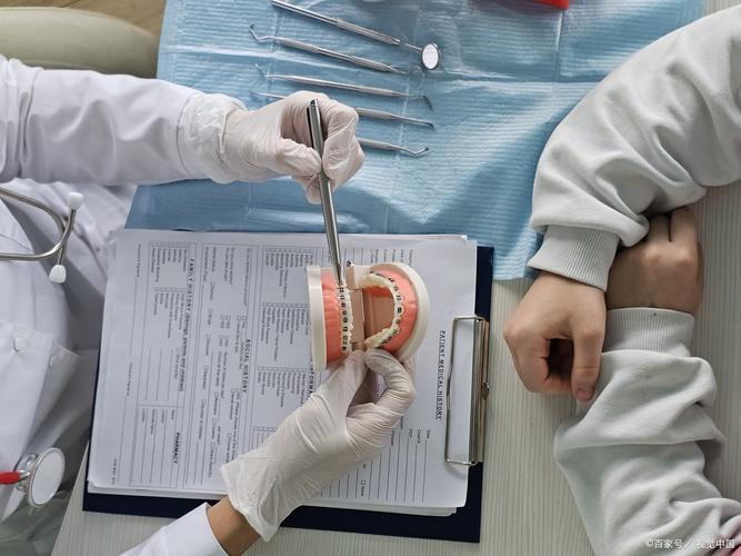 正畸八字结扎作用-图1