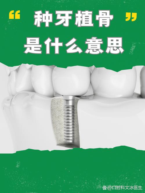 正畸为什么要植骨-图1 正畸为什么要植骨-图1
