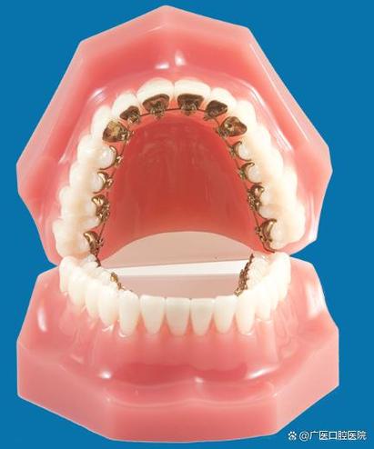 正畸颊面管的长度-图1