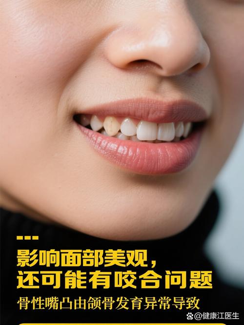 正畸对嘴巴的影响具体有哪些？-图2