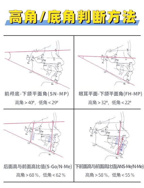 正畸面轴角的测量-图1