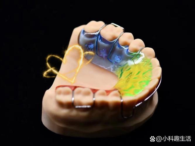 正畸咬合平面导板是什么？对咬合矫正有何作用？-图1