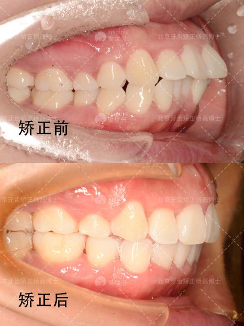 家附近正畸正颌哪家靠谱?选对机构和医生要注意啥?-图3 家附近正畸正颌哪家靠谱?选对机构和医生要注意啥?-图3