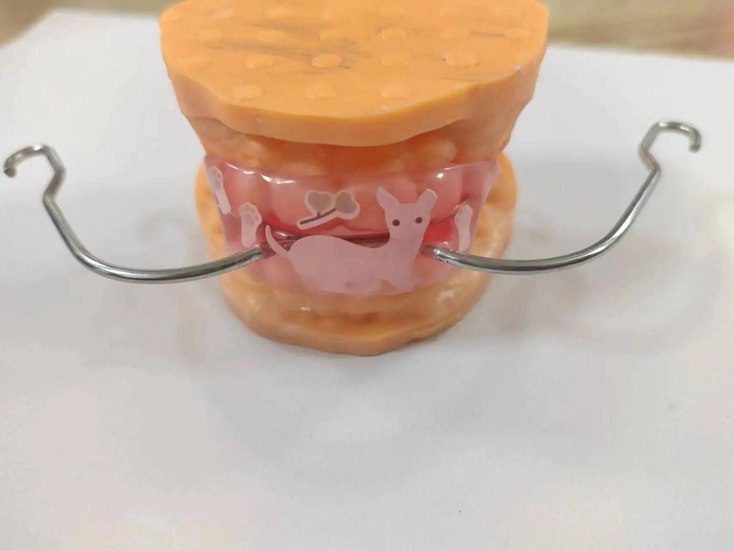 13岁正畸用口外弓有必要吗?有哪些注意事项?-图3 13岁正畸用口外弓有必要吗?有哪些注意事项?-图3