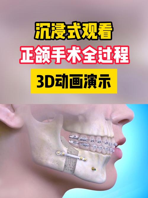 口腔正畸开合，矫正视频能解答哪些疑问？-图2