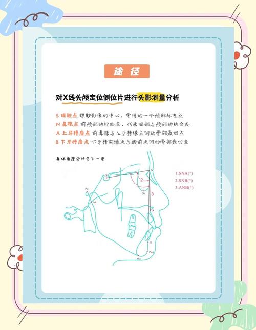 正畸矫正中头影测量如何精准指导治疗？-图3