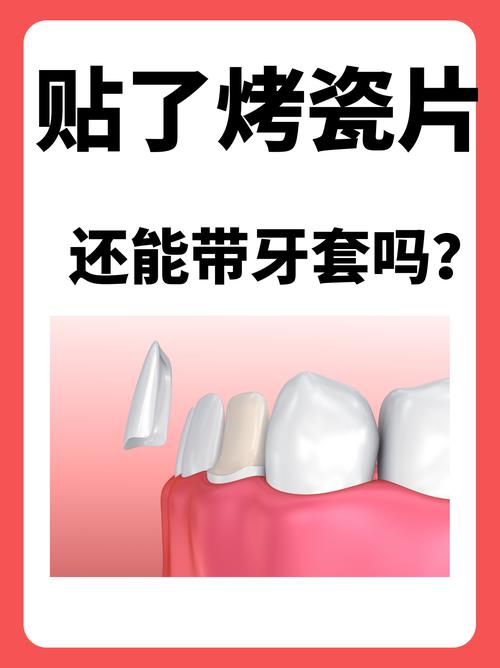 烤瓷冠能配合正畸治疗吗？-图3