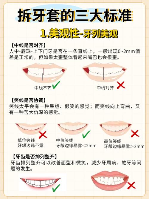 人正畸的施力原则-图3 人正畸的施力原则-图3