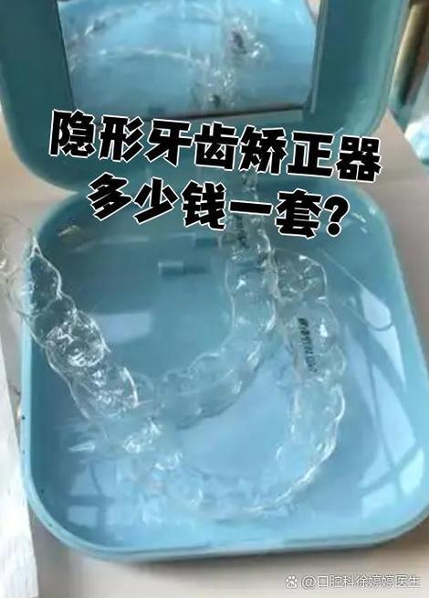 西安隐形正畸多钱-图3