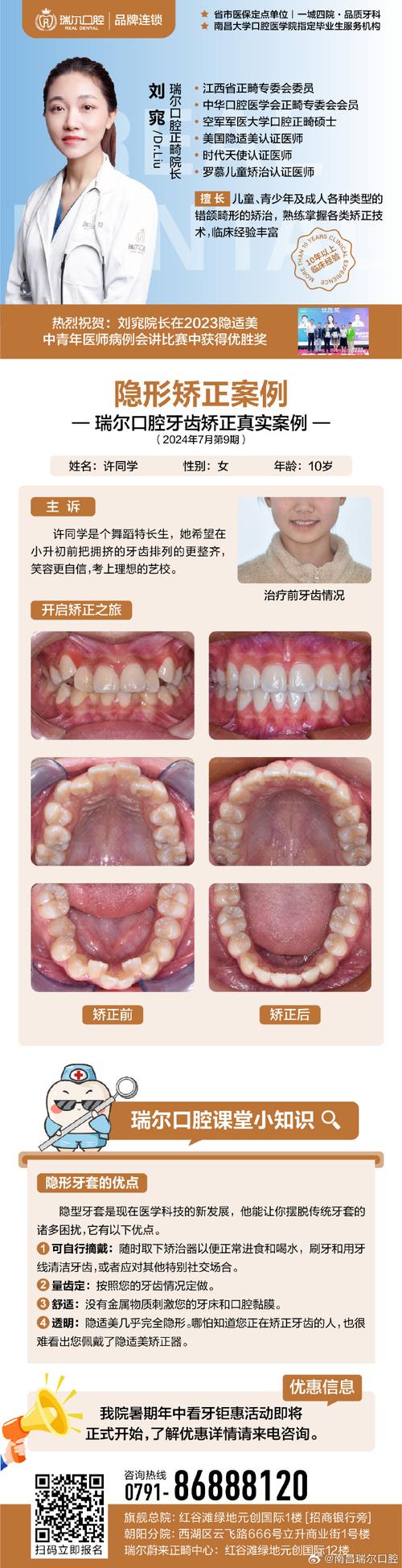 全隐形正畸究竟是什么？这种隐形矫正方式你了解吗？-图2