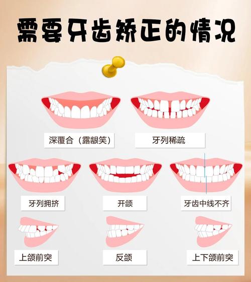 正畸临床常见问题有哪些?医生如何解答?-图3 正畸临床常见问题有哪些?医生如何解答?-图3
